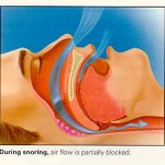 During Snoring