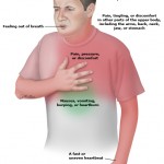 Heart_attack_symptoms_PI_edit