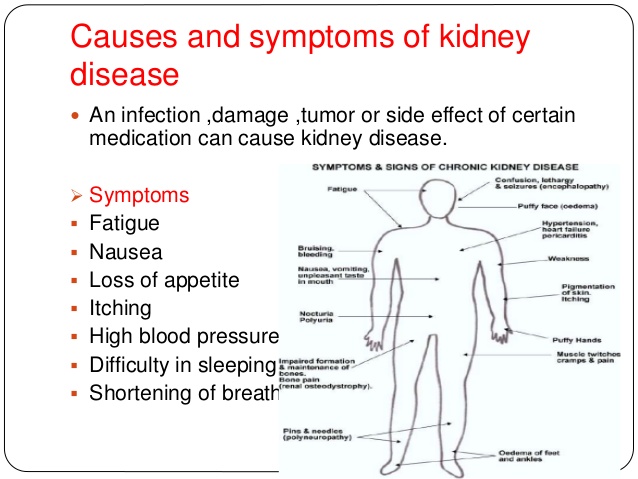Image result for ADDRESS THE CAUSE OF KIDNEY FAILURE PIC
